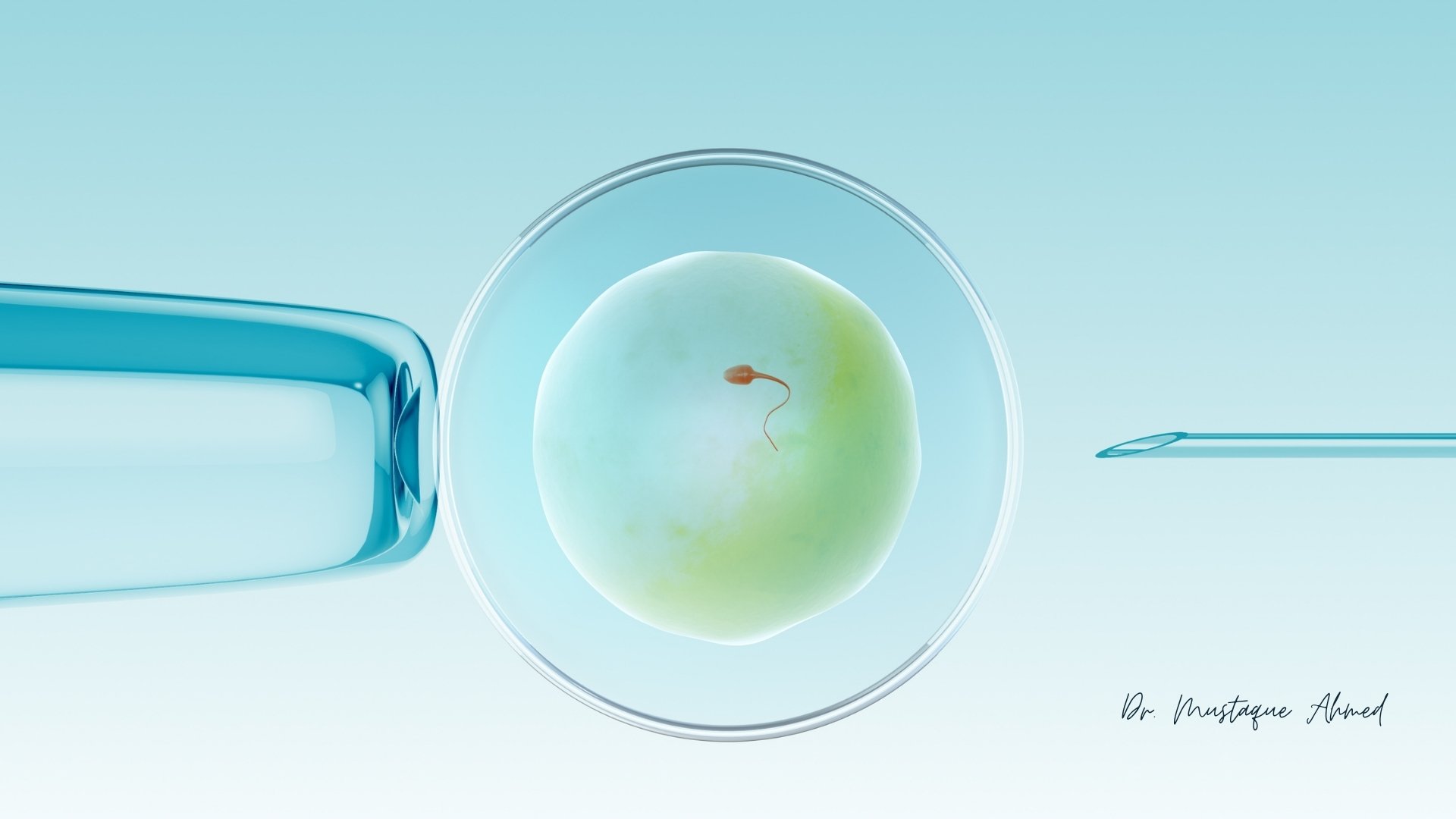 ICSI (Intracytoplasmic Sperm Injection) Service by Dr. Mustaque Ahmed